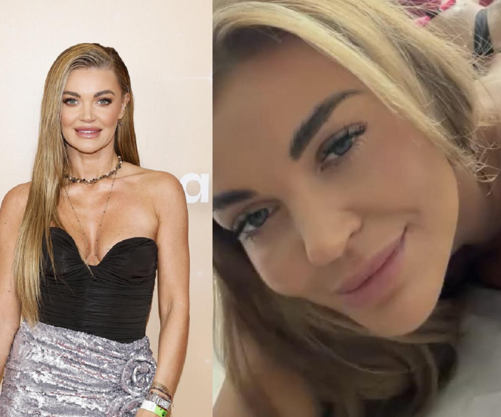 Edyta Folwarska pokazała zabieg na pośladki