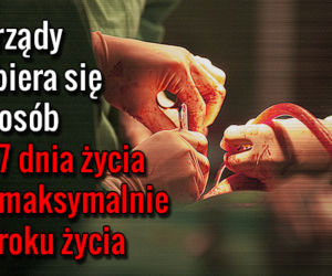 TRANSPLANTACJA_03 Narządy pobiera się od osób od 7 dnia życia do max 70 roku życia