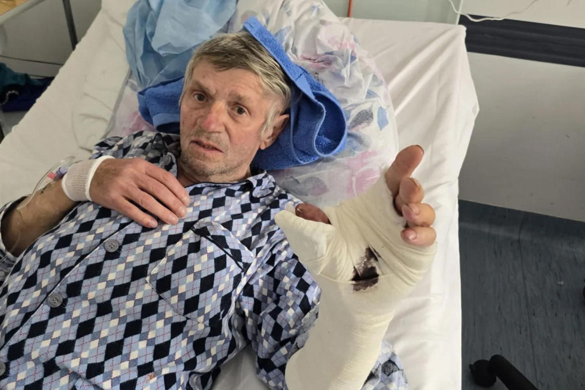 "Palec czy papierosy?" Emeryt podjął dramatyczną decyzję. Dziś ma i kciuka i nowe życie