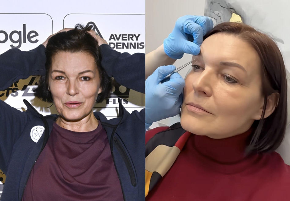 Ilona Felicjańska wycina sobie powieki