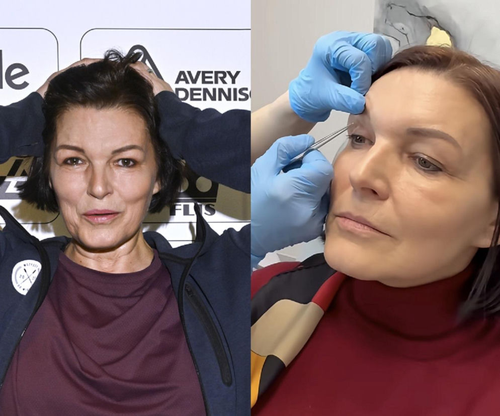 Ilona Felicjańska wycina sobie powieki
