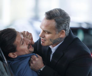 Jan Wieczorkowski przed przeszczepem włosów