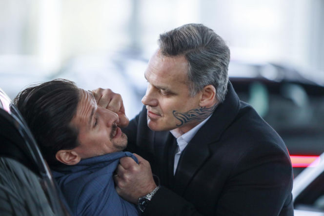 Jan Wieczorkowski przed przeszczepem włosów