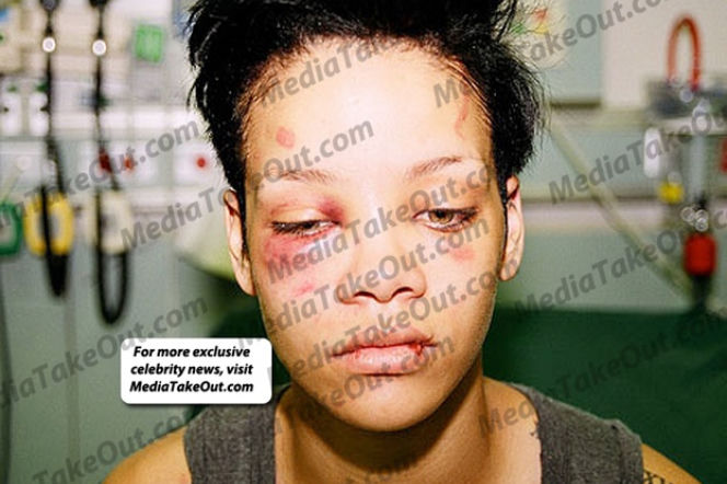 Pobita Rihanna