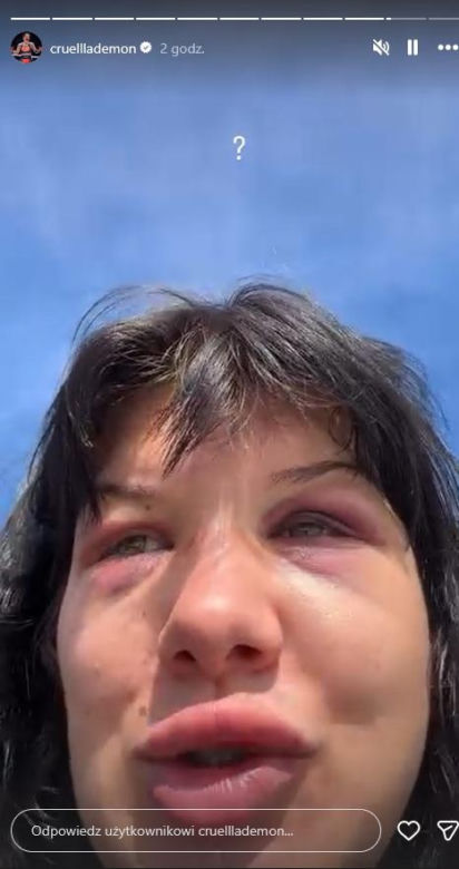 Dominika Rybak po walce
