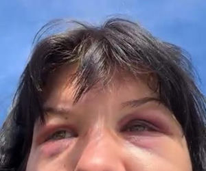 Dominika Rybak po walce