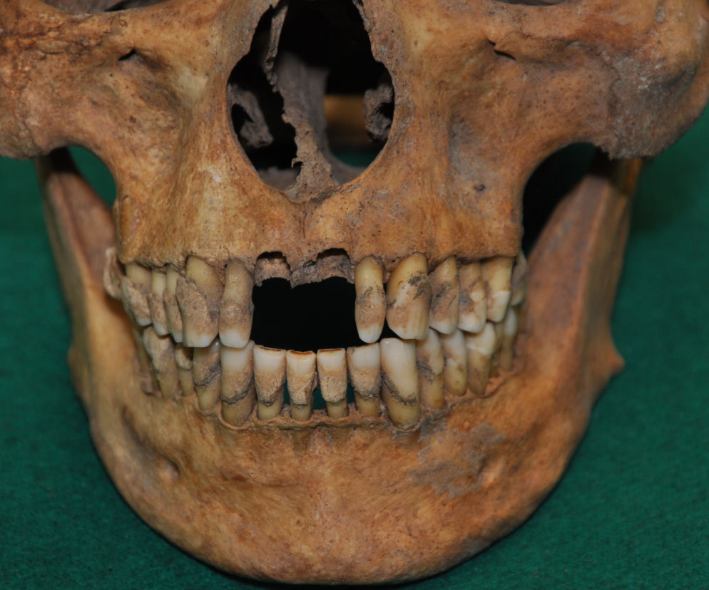 Badania antropologiczne