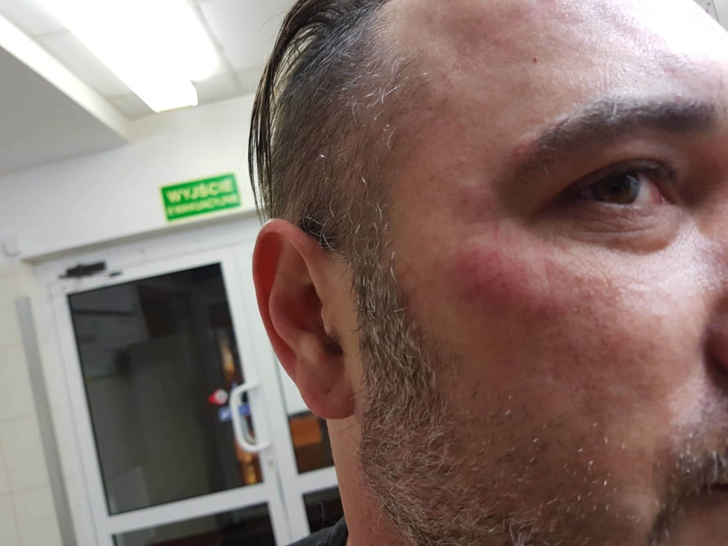 Dostałem zawału przez policję