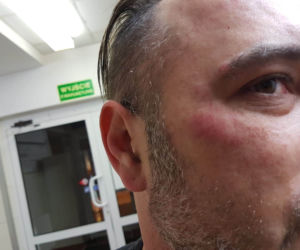 Dostałem zawału przez policję