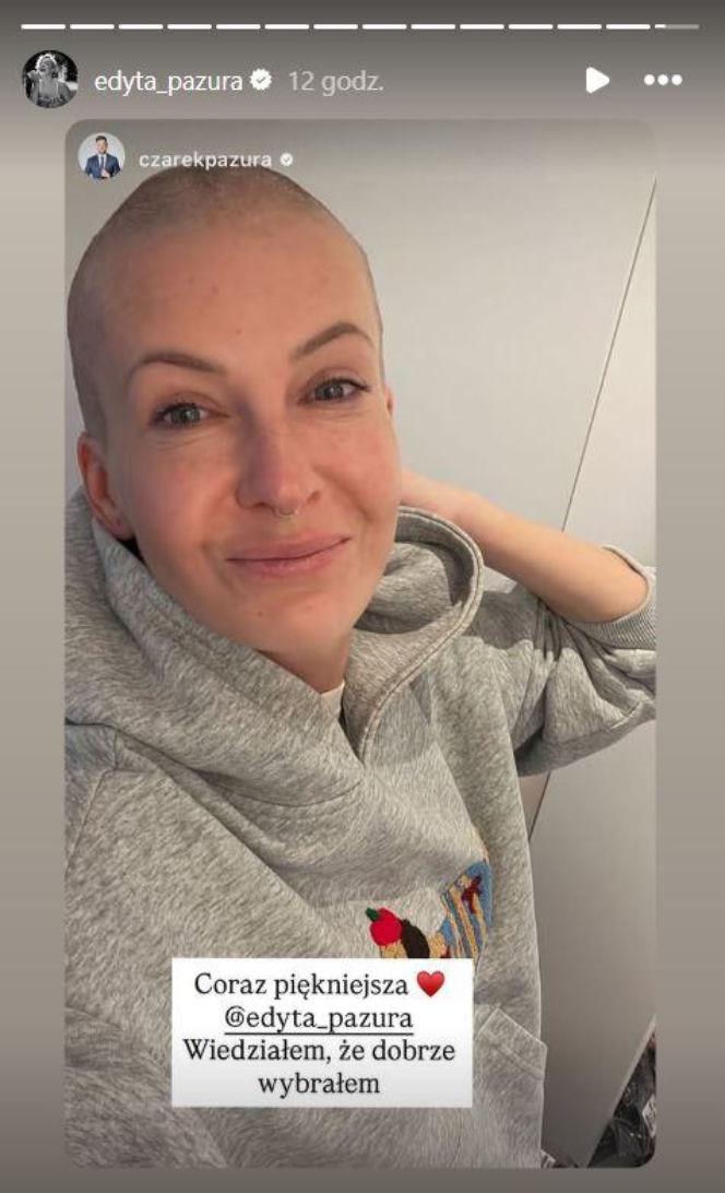 Gwiazdy zgoliły włosy w szczytnym celu