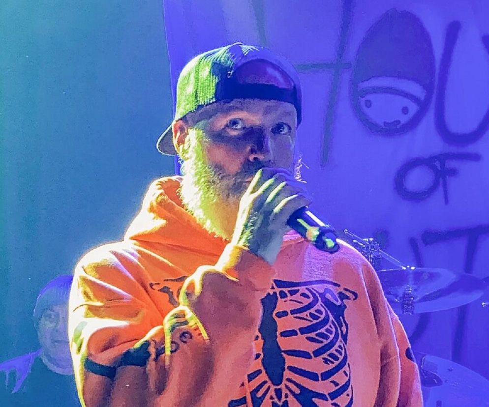 Fred Durst