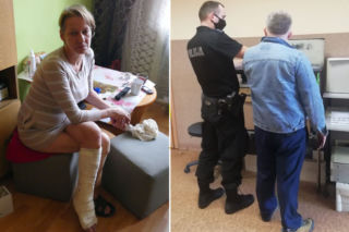 ŁÓDŹ. Pociął nożem swoją żonę. Niespodziewane słowa ciężko rannej kobiety [FOTO]