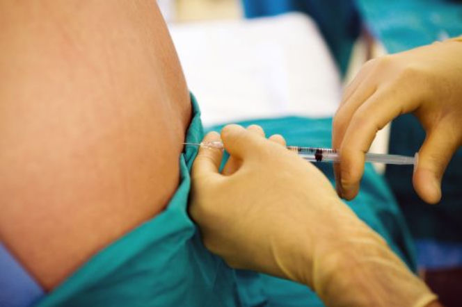 Znieczulenie przy porodzie – na czym polega znieczulenie zewnątrzoponowe i co czuje rodząca