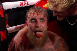 Anthony Joshua – Jake Paul: Złamana szczęka YouTubera ! Tak wyglądała jego twarz po walce [GALERIA]