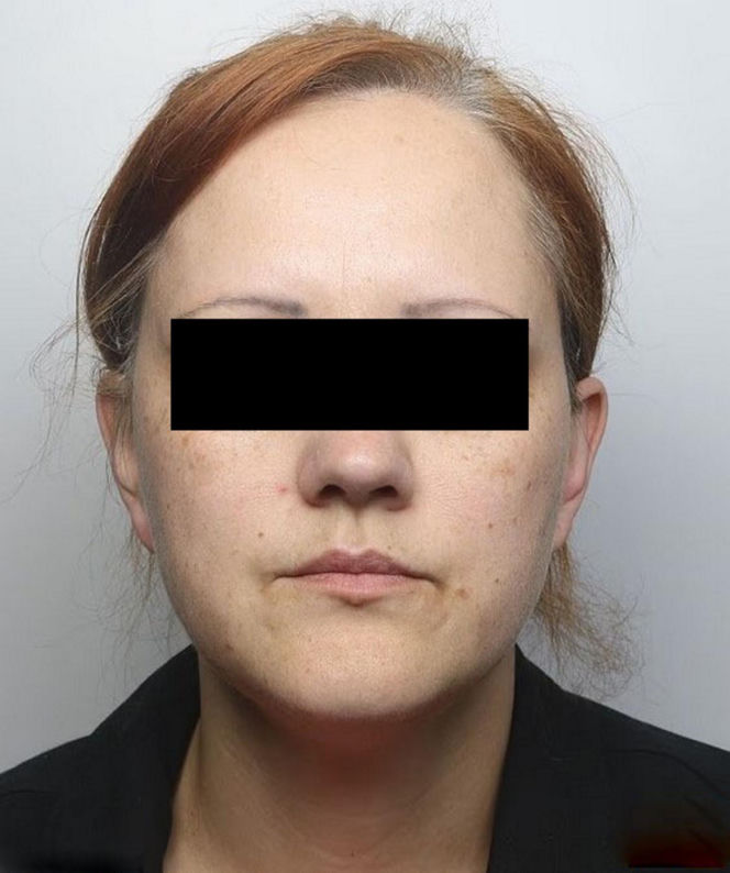 Kochanka zabiła Izę, bo nie chciała zostać mężczyzną! Sąd podjął decyzję