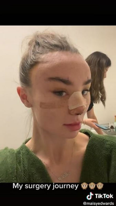Znana influencerka pojechała do Turcji "zrobić" sobie nos. Wydała 50 tys. zł, fani bezlitośni: "Jest gorzej"