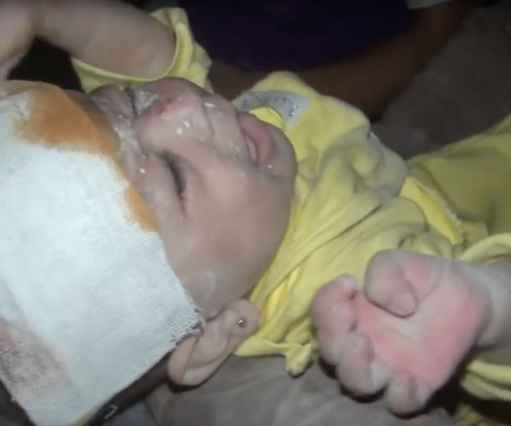NIEMOWLAK WYCIĄGNIĘTY SPOD GRUZÓW ALEPPO.