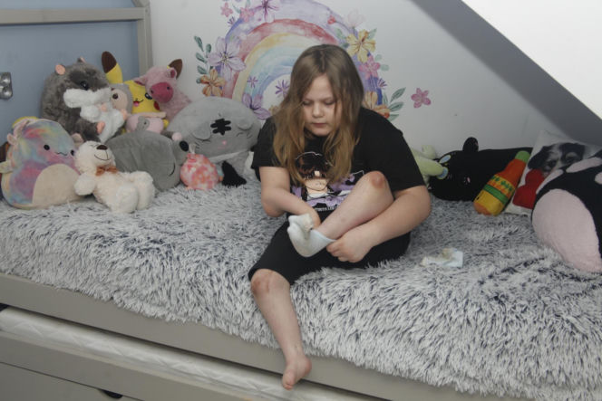 Czołgam się, bo nie mamy na ortezy