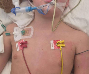 8-letni Dawid przestał oddychać w nocy. Na karetkę czekali 24 minuty