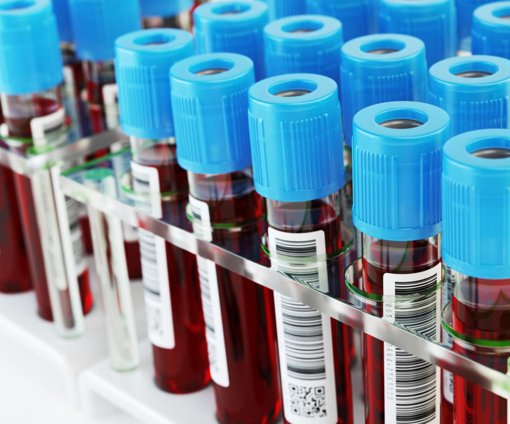 Probówki z próbkami krwi w stojaku laboratoryjnym, symbolizujące badania nad cukrzycą typu 2 i jej wpływem na ryzyko zawału. Czerwone krwinki są kluczowe w odkryciach naukowców, o których przeczytasz więcej na portalu Poradnik Zdrowie.