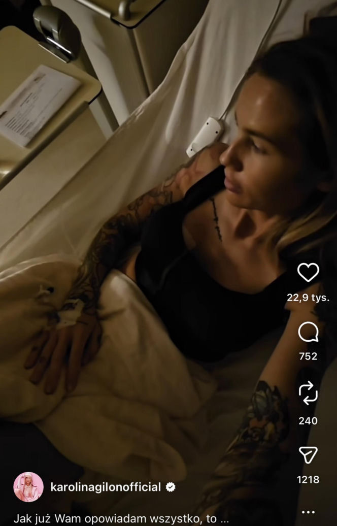 Karolina Gilon zoperowała biust. Zdjęcia przed i po