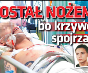 Dostał nożem bo krzywo spojrzał