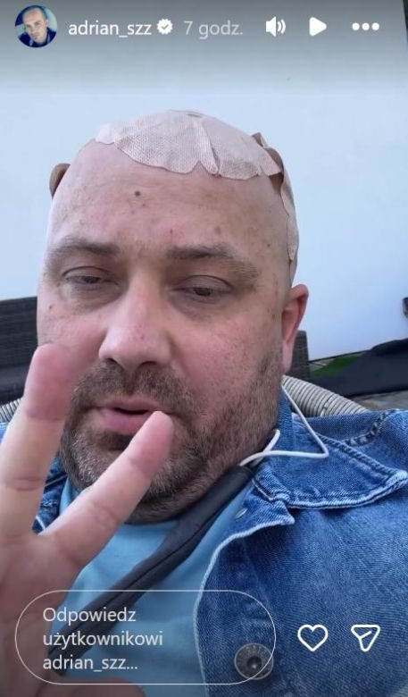 Adrian ze "Ślubu od Pierwszego Wejrzenia" ma obrzęk mózgu. Walczy też z podwójnym widzeniem