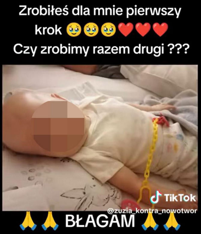 Mała Zuzia z Łódzkiego pilnie potrzebuje pomocy! Po 3 miesiącach od urodzenia wykryto u niej złośliwy nowotwór [ZDJĘCIA]