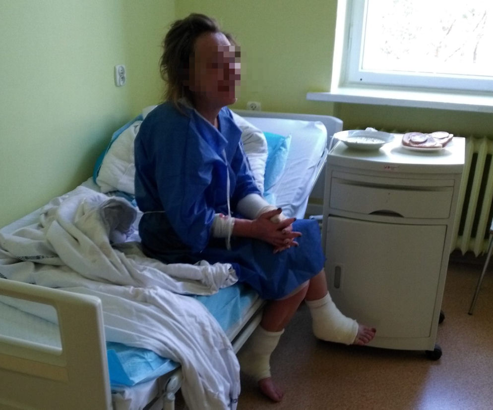Pijana pacjentka spaliła pomieszczenie na szpitalnym oddziale ratunkowym