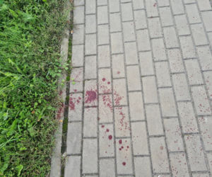 Leżajsk. Obciął dłoń maczetą [ZDJĘCIA]