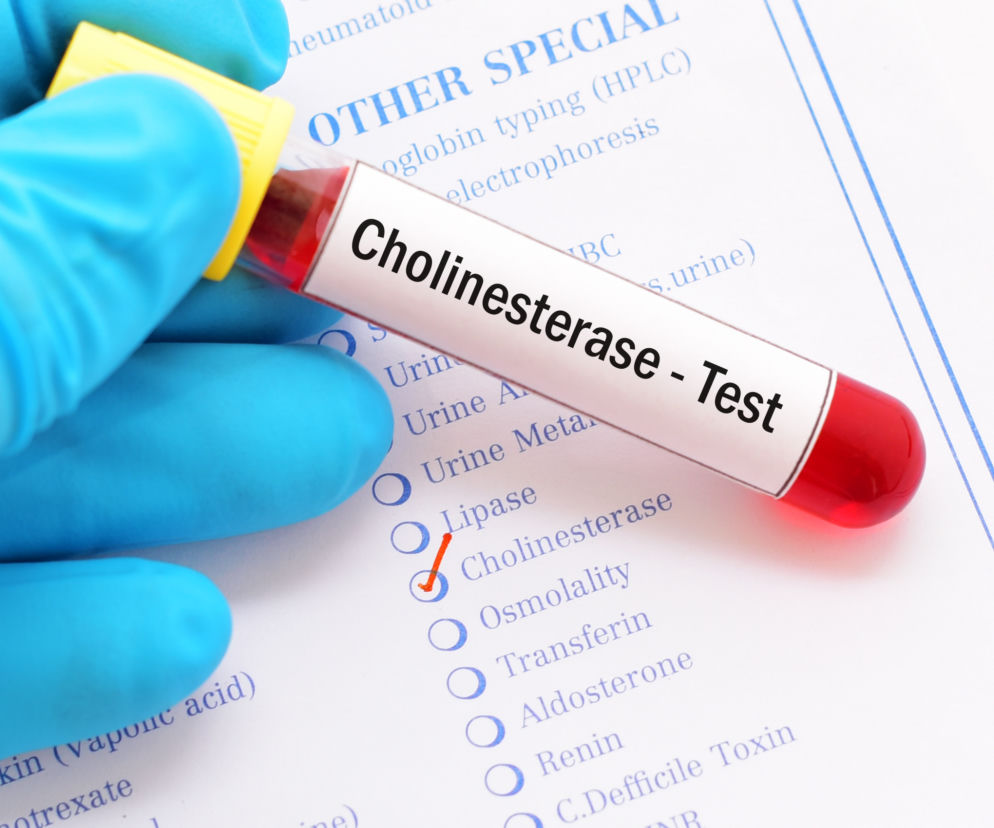 Cholinoesterazy (estrazy cholinowe)