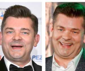 Zenek Martyniuk ma nowe zęby 