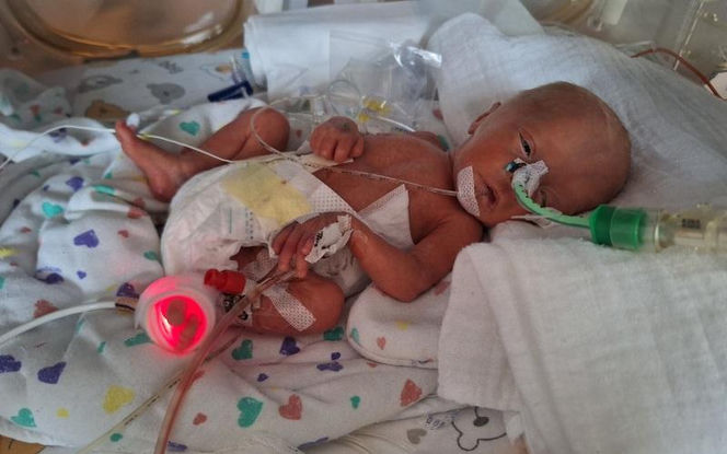 Dzień Wcześniaka w Szpitalu św. Zofii w Warszawie