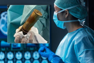 Pacjent z pociskiem artyleryjskim w odbycie! Saperzy na oddziale!