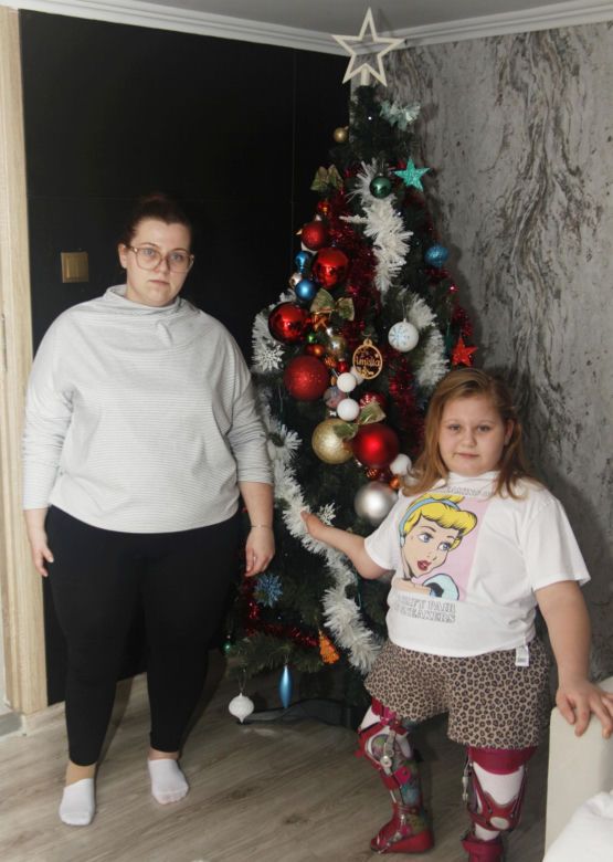 Podarujmy Amelce protezy pod choinkę