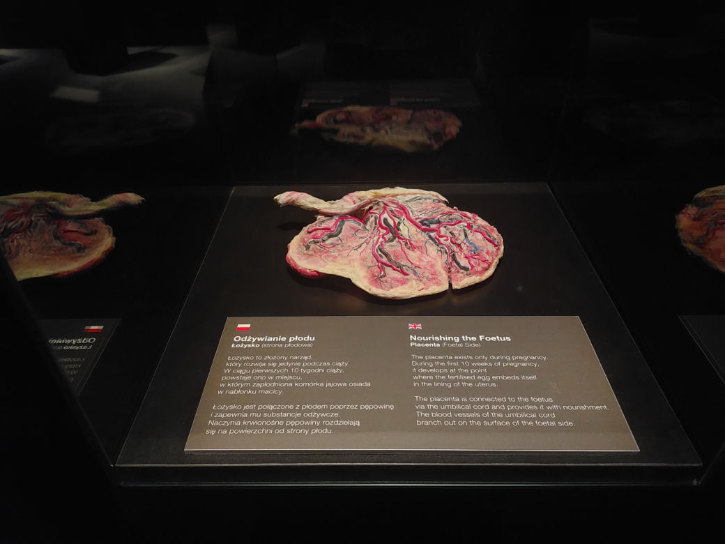 Wystawa Body Worlds w Szybie Wilson w Katowicach