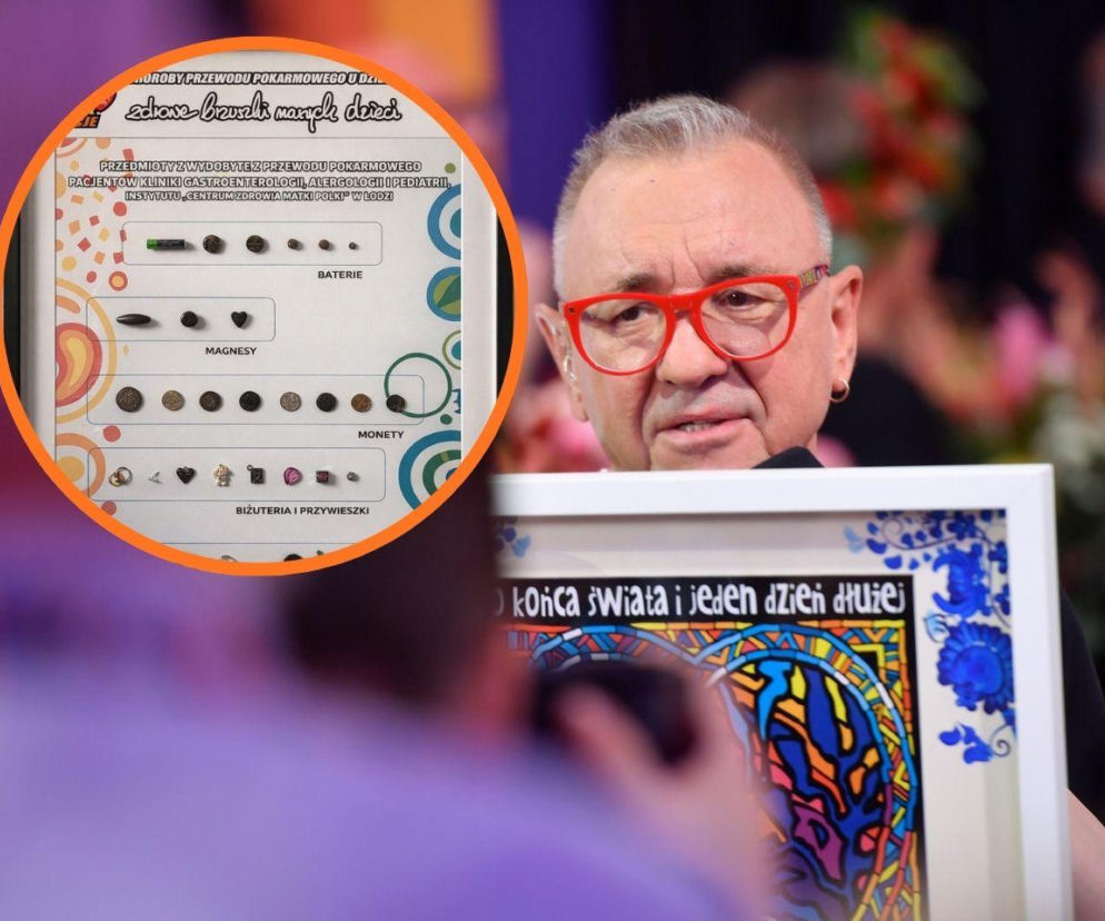 Te przedmioty lekarze wyjmują z dziecięcych żołądków. Tablica grozy z CZMP trafiła na aukcję WOŚP