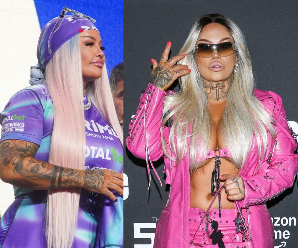 Laluna podda się poważnej operacji! Wszystko przez wagę. Celebrytka nie przebiera w słowach: Jestem teraz utyta jak świnia