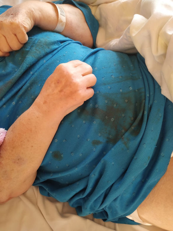 Kobieta jest brudna, niezadbana. Na koszuli ma ślady krwi