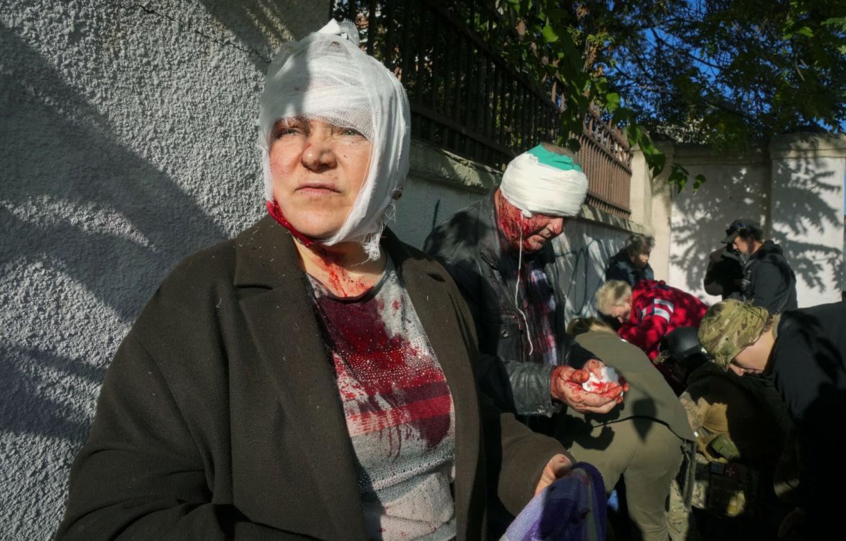 Ranni po rosyjskim ostrzale z 10.10.2022