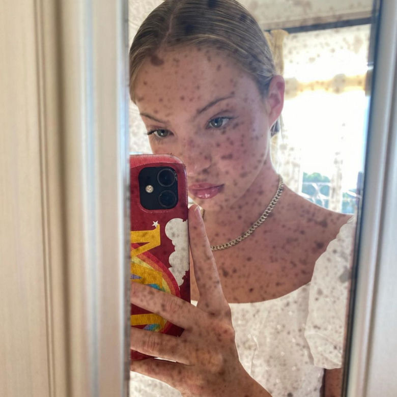 19-letnia córka Kate Moss na odważnych zdjęciach. O mamie mówi: "Jest stara, nudna i nosi dresy