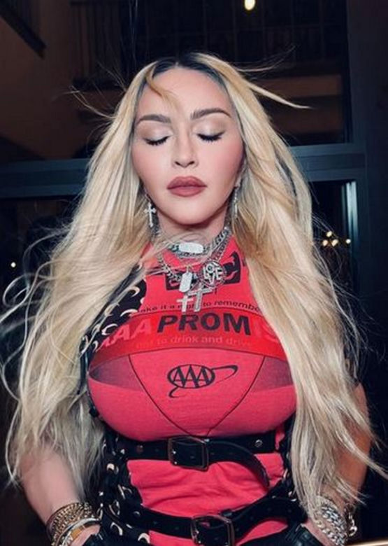  Madonna ma nową twarz! 64-latka przeszła kolejne operacje?