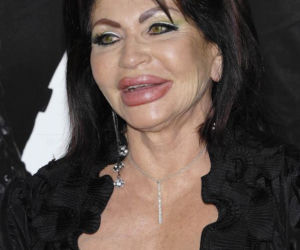 Jackie Stallone, ofoary operacji plastycznych