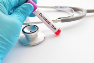 Nawet 21 milionów Polaków ma zbyt wysoki cholesterol. Ta liczba z badania krwi zdradza realne ryzyko zawału