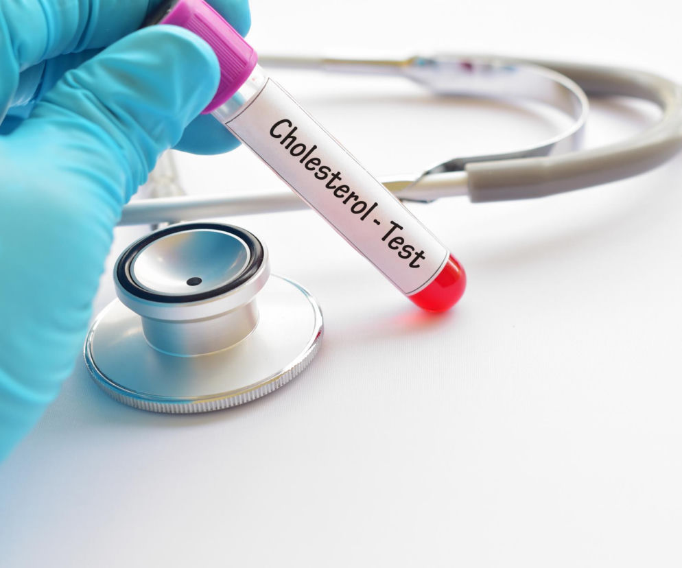 Ręka osoby w niebieskiej rękawiczce trzyma probówkę z krwią i napisem Cholesterol - Test. O badaniach na Poradnik Zdrowie.