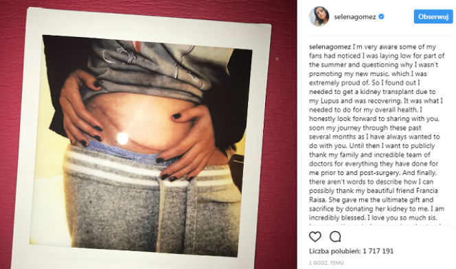 Selena Gomez miała przeszczep nerki!