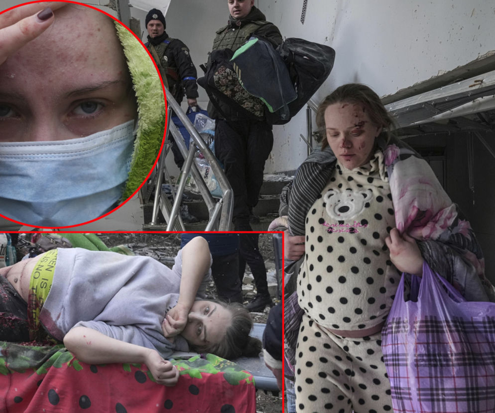 Rosjanie zbombardowali dziecięcy szpital. Są ranni, wśród nich kobieta w ciąży. Porażające zdjęcia