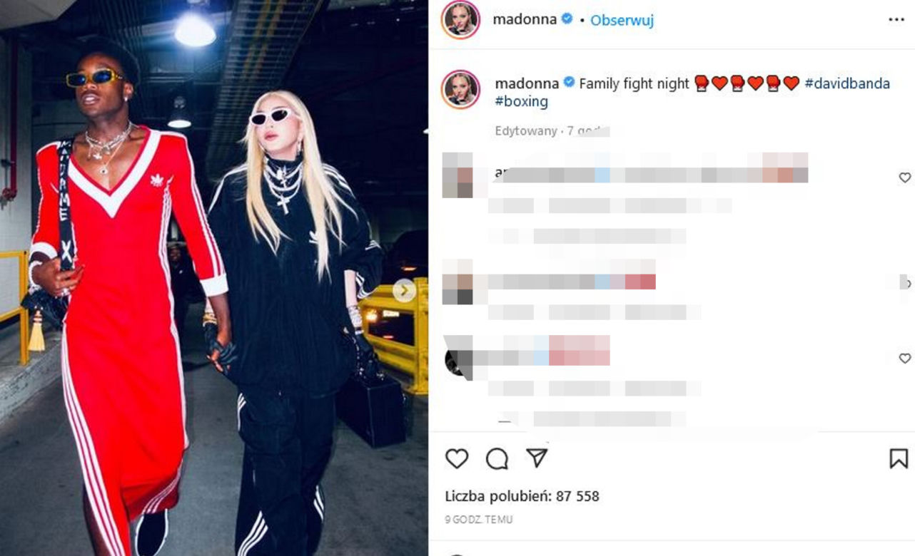  Madonna ma nową twarz! 64-latka przeszła kolejne operacje?