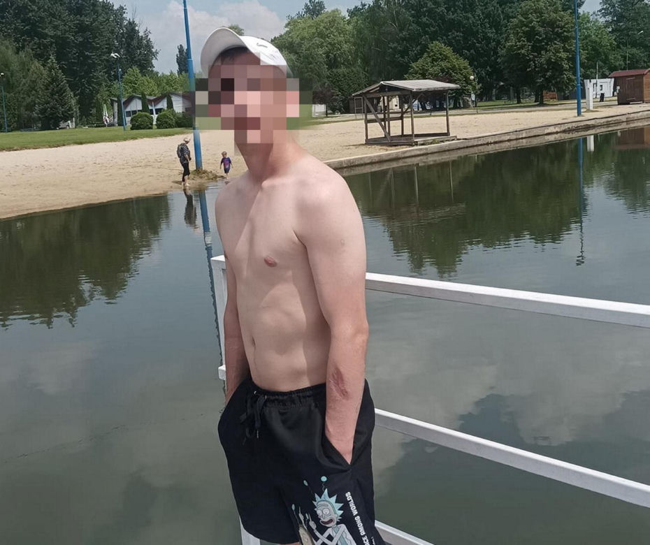 Horror na imprezie. Krystian został znienacka skatowany. Bandzior skakał mu po głowie