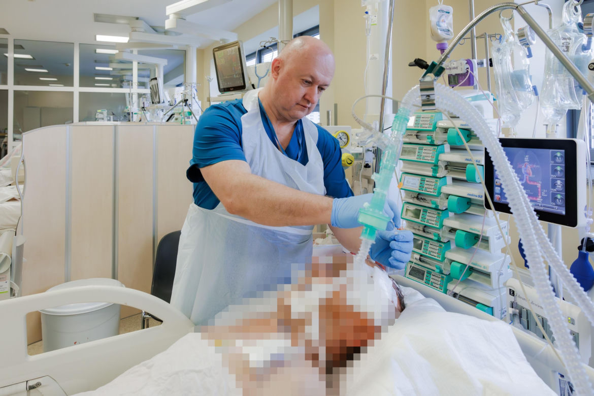 Lubelski szpital ma pierwszy w Polsce aparat do mikrodializy mózgu. To większe szanse dla pacjentów [GALERIA]